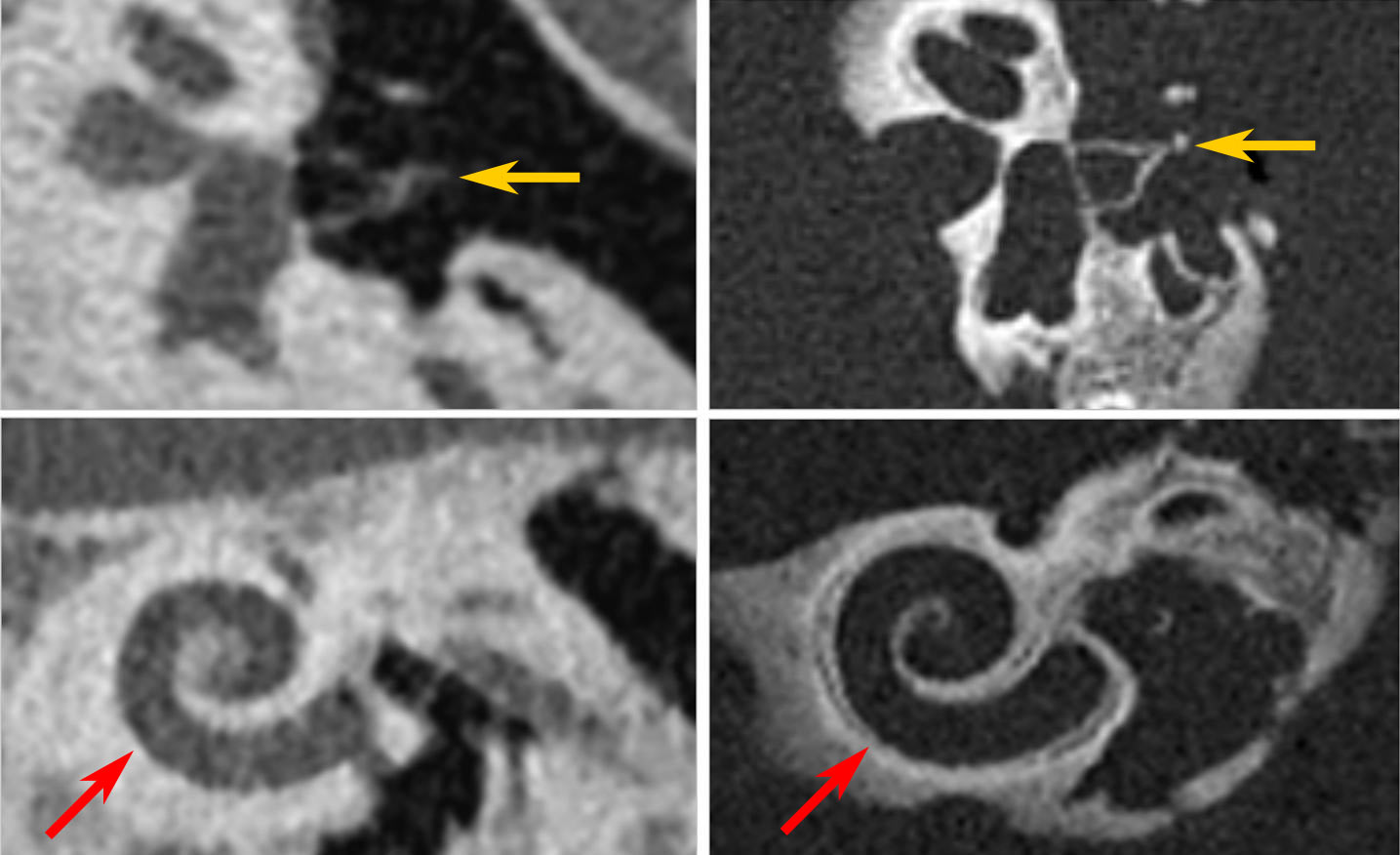 Article Single Image